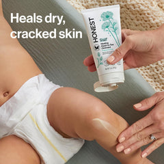The Honest Company Head to Toe Multi-Purpose Healing Ointment, Safe for Sensitive Skin, Hypoallergenic, Fragrance-Free, Vegan, 5 oz